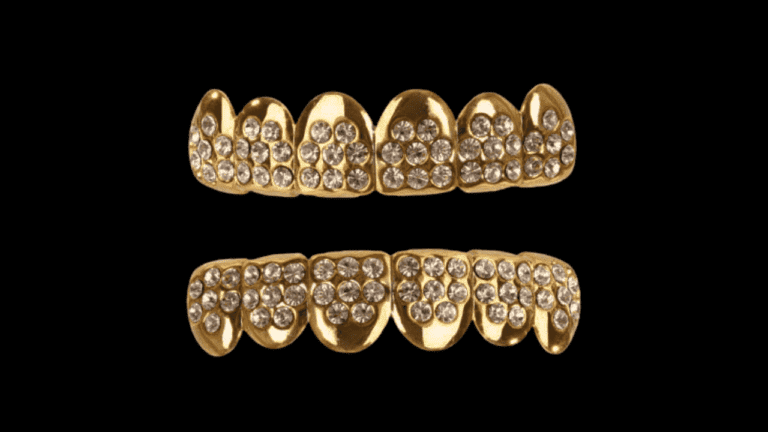 10k vs 14k Gold Grillz: What Is Difference Between Both the Karats?